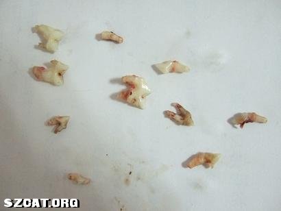 好多牙齿已经烂得只剩牙根了